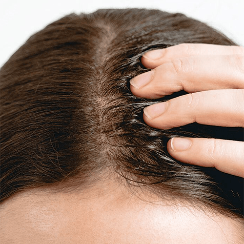 The Ordinary Multi-Peptide Serum for Hair Density